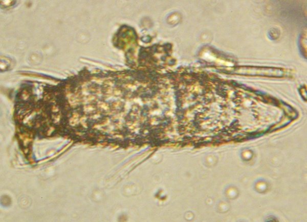 Echiniscus sp1.JPG