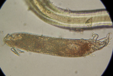 Eriophyes tiliae-tomentosae (2).JPG