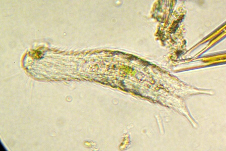 Chaetonotus sp (1).JPG