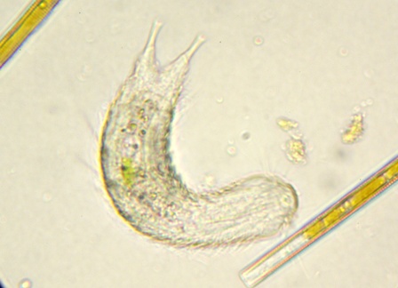 Chaetonotus sp (2).JPG